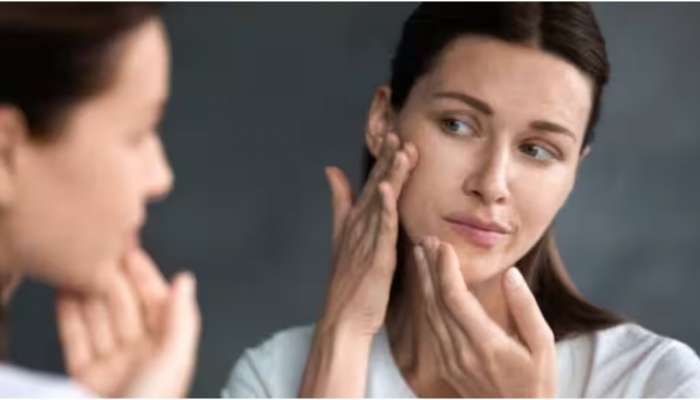 Pimples problem: മുഖത്ത് അടിക്കടി മുഖക്കുരു വരാറുണ്ടോ? ഇതാ നിങ്ങളുടെ പ്രശ്‌നത്തിന് ശാശ്വത പരിഹാരം!