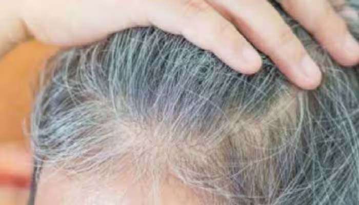 Grey Hair Treatment: മുടി ഒരിയ്ക്കലും നരയ്ക്കില്ല, ഭക്ഷണക്രമത്തില്‍ ഇവ ഉള്‍പ്പെടുത്തൂ