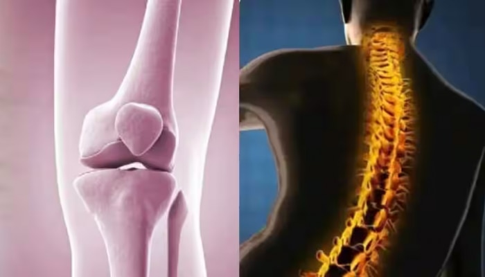 Bone Health: എല്ലുകൾ കാരിരുമ്പു പോലാകാൻ കാൽസ്യം മാത്രം പോരാ..! ഈ പോഷകങ്ങളും ആവശ്യമാണ്