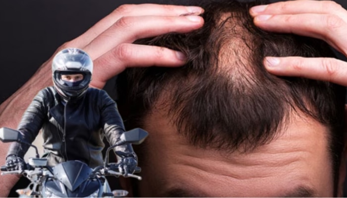 Helmet cause hair loss: ഹെൽമറ്റ് വെക്കുന്നത് പുരുഷന്മാരിൽ കഷണ്ടിക്ക് കാരണമാകുന്നോ? ഈ കാര്യങ്ങൾ അറിഞ്ഞിരിക്കുക!