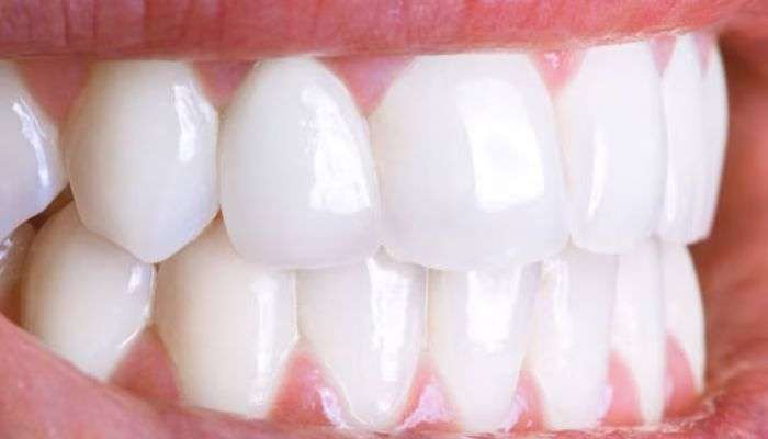 Fun Facts About Teeth: പല്ലിനും പറയാനുണ്ട്‌ രസകരമായ ചില കാര്യങ്ങള്‍....