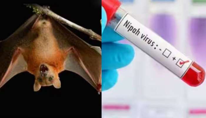 Nipah Virus: നിപ വൈറസ്; കോഴിക്കോടും സമീപ ജില്ലകളിലും അതീവ ജാ​ഗ്രത നിർദേശം, കണ്ടെയ്ൻമെന്റ് മേഖലകൾ പ്രഖ്യാപിച്ചു