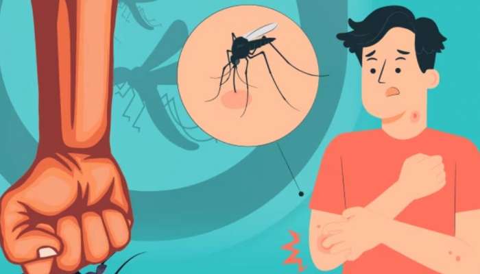 Dengue Fever: ഡെങ്കിപ്പനിയുടെ മൂന്ന് നിർണായക ഘട്ടങ്ങൾ; ശ്രദ്ധിക്കേണ്ട ഘട്ടങ്ങൾ ഇവയാണ്