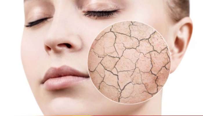 Face Skin and Vitamins: വരണ്ട ചര്‍മ്മമാണോ നിങ്ങളുടെ പ്രശ്നം? ഈ വിറ്റാമിനുകൾ കഴിച്ചോളൂ മുഖം തിളങ്ങും.