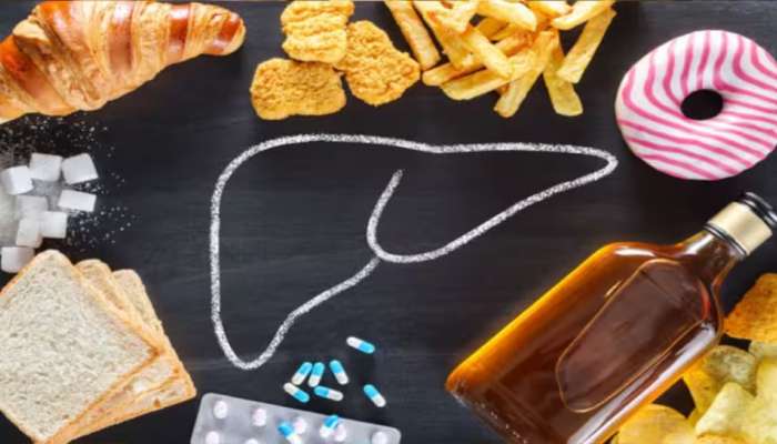 Liver Health: മദ്യം മാത്രമല്ല... ഈ 5 ഭക്ഷണങ്ങളും കരളിനെ തകരാറിലാക്കും!