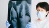 Tuberculosis: ക്ഷയരോഗ നിവാരണ പ്രവർത്തനങ്ങൾക്ക് കേരളത്തിന് ദേശീയ പുരസ്‌കാരം