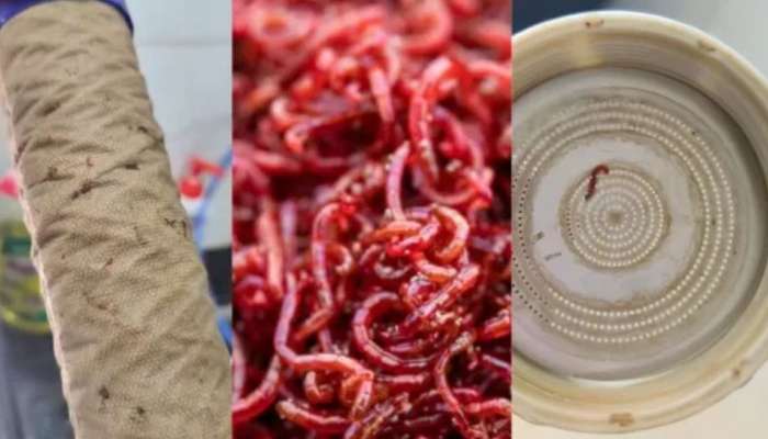 Bloodworm: കുടിവെള്ളത്തിൽ രക്തപ്പുഴു ബാധ, ഇത് മനുഷ്യരെ എങ്ങനെ ബാധിക്കും, അറിയാം 