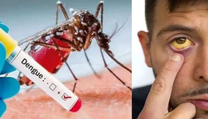 Dengue Fever Alert: ചൂടിന് ശമനം നൽകി വേനൽമഴ; എന്നാൽ, ഡെങ്കിപ്പനിയും മഞ്ഞപ്പിത്തവും വെല്ലുവിളി, മുൻകരുതൽ വേണമെന്ന് ആരോ​ഗ്യവകുപ്പ്