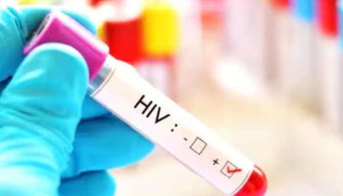 Tripura Hiv Cases: ത്രിപുരയിൽ എച്ച്ഐവി കേസുകൾ വ‍‍ർധിക്കുന്നു; ജാഗ്രതാ നിർദേശം, 47 വിദ്യാർഥികൾ മരിച്ചു, 828 പേർക്ക് രോ​ഗബാധ