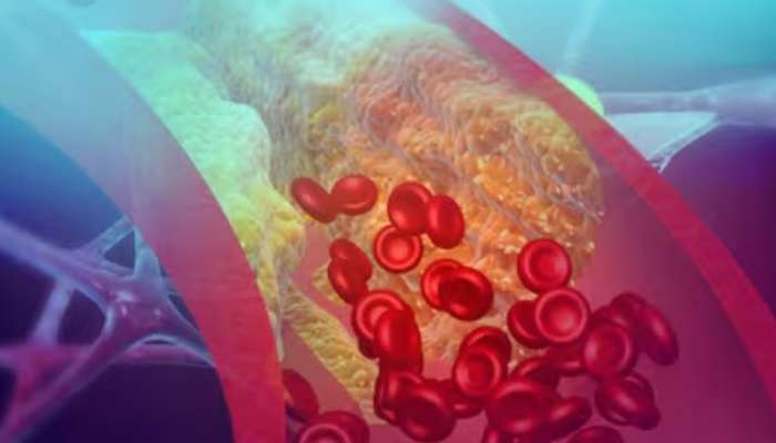 High Cholesterol: കൊളസ്ട്രോൾ കുറയ്ക്കാം ഹൃദയാരോ​ഗ്യം വർധിപ്പിക്കാം... ഈ ഭക്ഷണങ്ങൾ സൂപ്പറാണ്