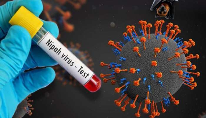 Nipah Virus: നിപ സംശയം, പനി ബാധിച്ച രണ്ട് പേരെ ആശുപത്രിയിലേക്ക് മാറ്റി; സമ്പർക്കപ്പട്ടികയിലുള്ളവരുടെ എണ്ണം 151 ആയി