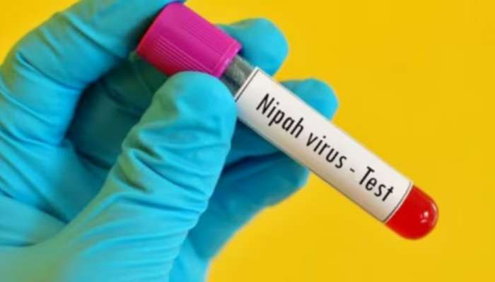 Nipah Virus: നിപയിൽ ആശ്വാസം; മൂന്ന് പേരുടെ നിപ പരിശോധനാ ഫലങ്ങള്‍ കൂടി നെഗറ്റീവ്