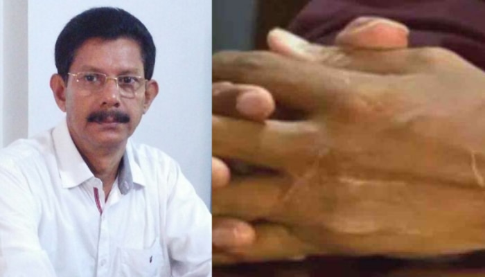 Prof TJ Joseph-Hand Chopping Case: പ്രൊഫ. ടിജെ ജോസഫിന്റെ കൈപ്പത്തി വെട്ടിയ കേസ്; മുഖ്യസൂത്രധാരന്റെ ശിക്ഷ മരവിപ്പിച്ച് ജാമ്യം അനുവദിച്ചു