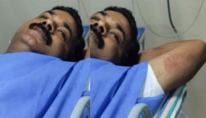 SI Attacked: വാഹനപരിശോധനയ്ക്കിടെ എസ്ഐയെ വാഹനമിടിപ്പിച്ച് കൊല്ലാൻ ശ്രമം; എസ്ഐ ഇഎം മുഹമ്മദിന് ​ഗുരുതര പരിക്ക്