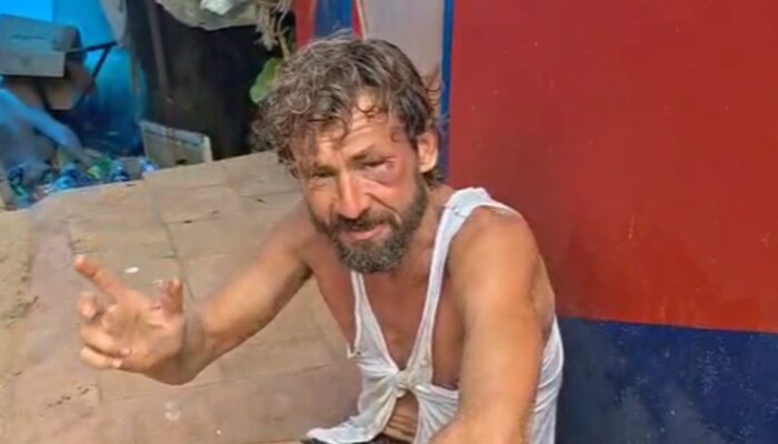 Foreigner Attacked in Varkala: വിദേശ പൗരന് വാട്ടർ സ്പോർട്സ് തൊഴിലാളികളുടെ ക്രൂരമർദ്ദനം; സംഭവം വർക്കലയിൽ