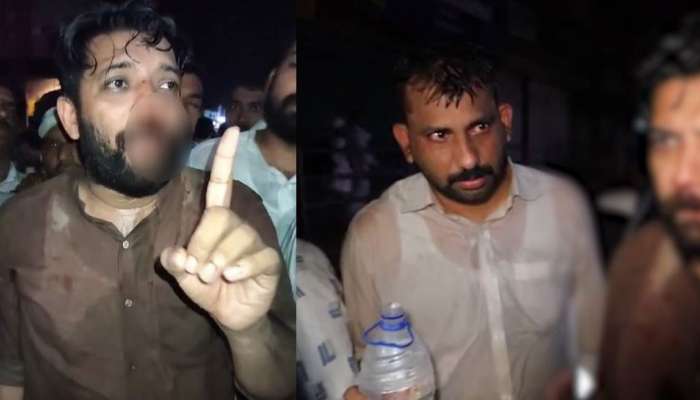 LDF-UDF Clash: ഷാഫിക്ക് മർദനമേറ്റ സംഭവം: പോലീസ് നടപടിക്ക് പിന്നാലെ ഷാഫി പറമ്പിൽ എംപിക്കെതിരെ കേസ്