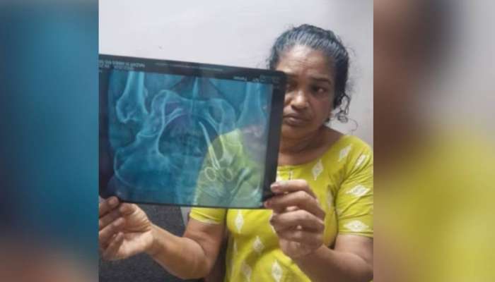 Vandanam Medical College: 'ശസ്ത്രക്രിയക്ക് നഴ്സുമാരുടെ അഭാവമുണ്ട്'; ചികിത്സാപിഴവിൽ പ്രതികരിച്ച് ഡോ. ഷാഹിദ